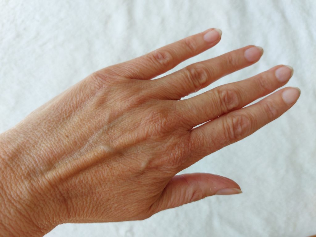 Tremorfrei | Ist essentieller Tremor heilbar?